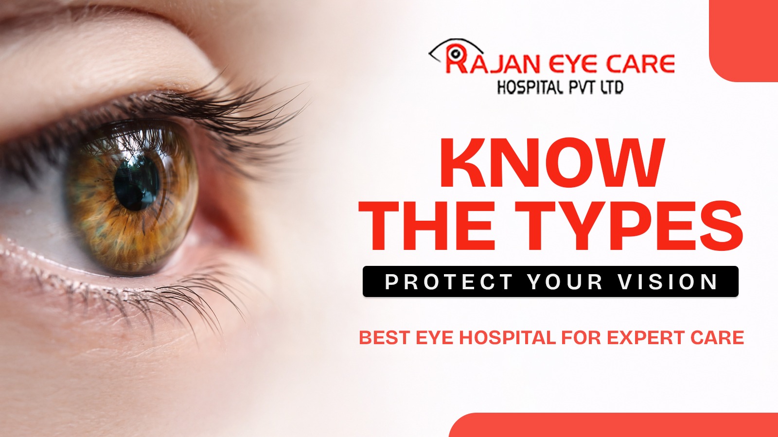 Eye hospital in Chennai